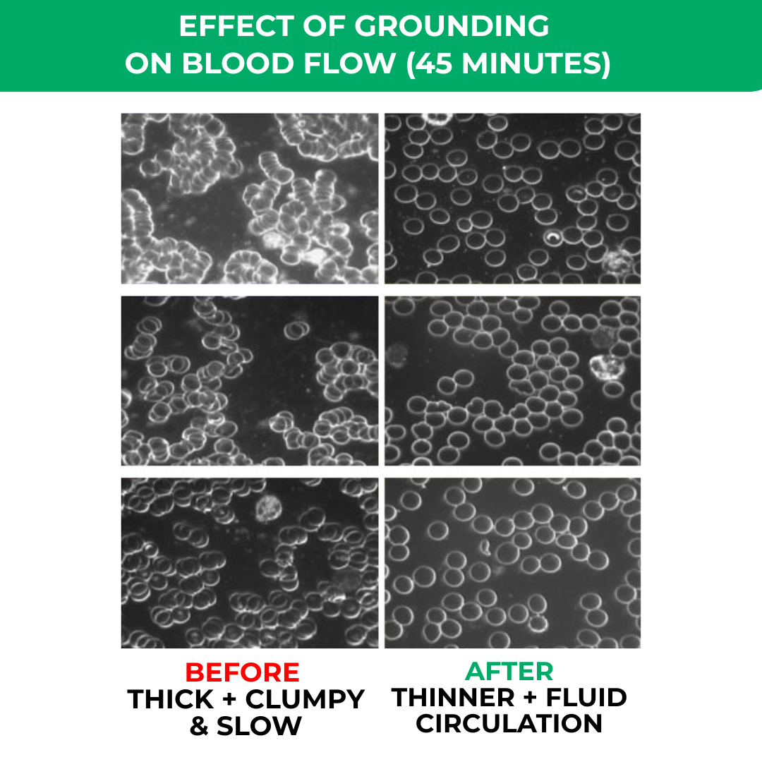 LiveGrounded™ Earthing Sheets.